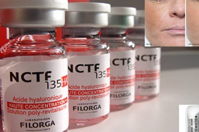 NCTF 135 Nanosoft kezelés NCTF 135 Nanosoft kezelés