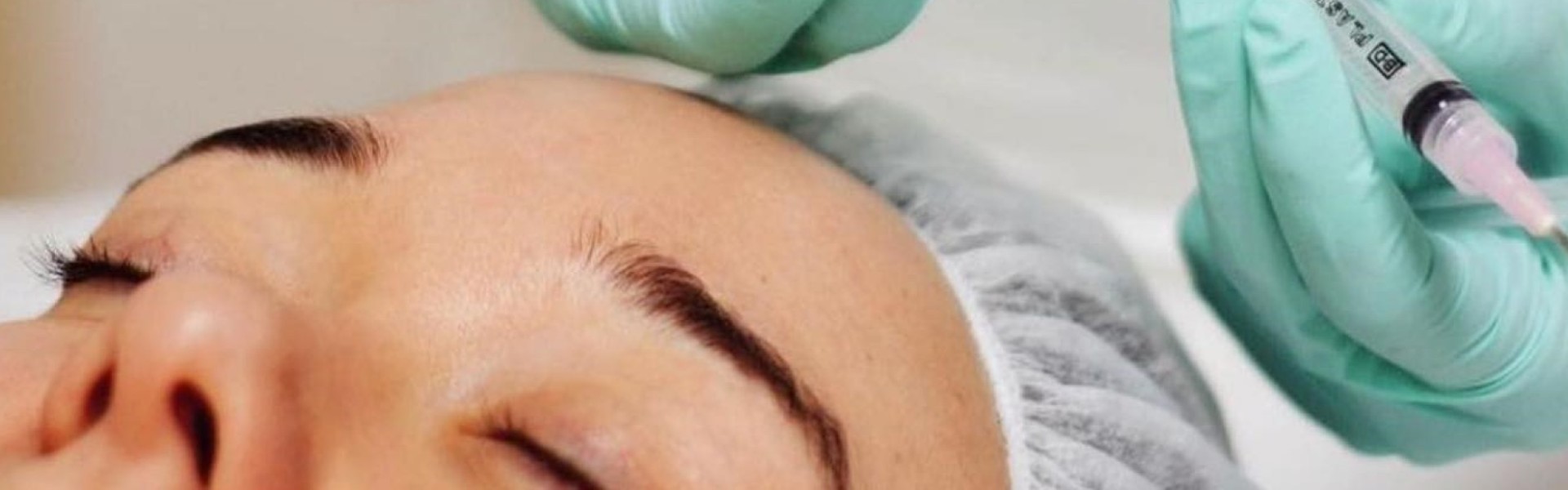 Bőrmegújító Bio-Microneedling Arckezelés