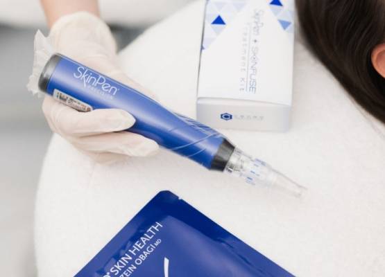 SkinPen: természetes bőrfiatalítás mikrotűs technológiával